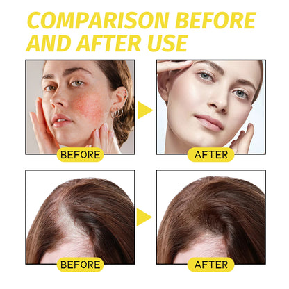 Hair Growth Essential Oil – Nourish Roots & Promote Thicker Hair