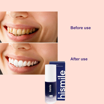 Purple Whitening Toothpaste – Color-Correcting for a Brighter Smile