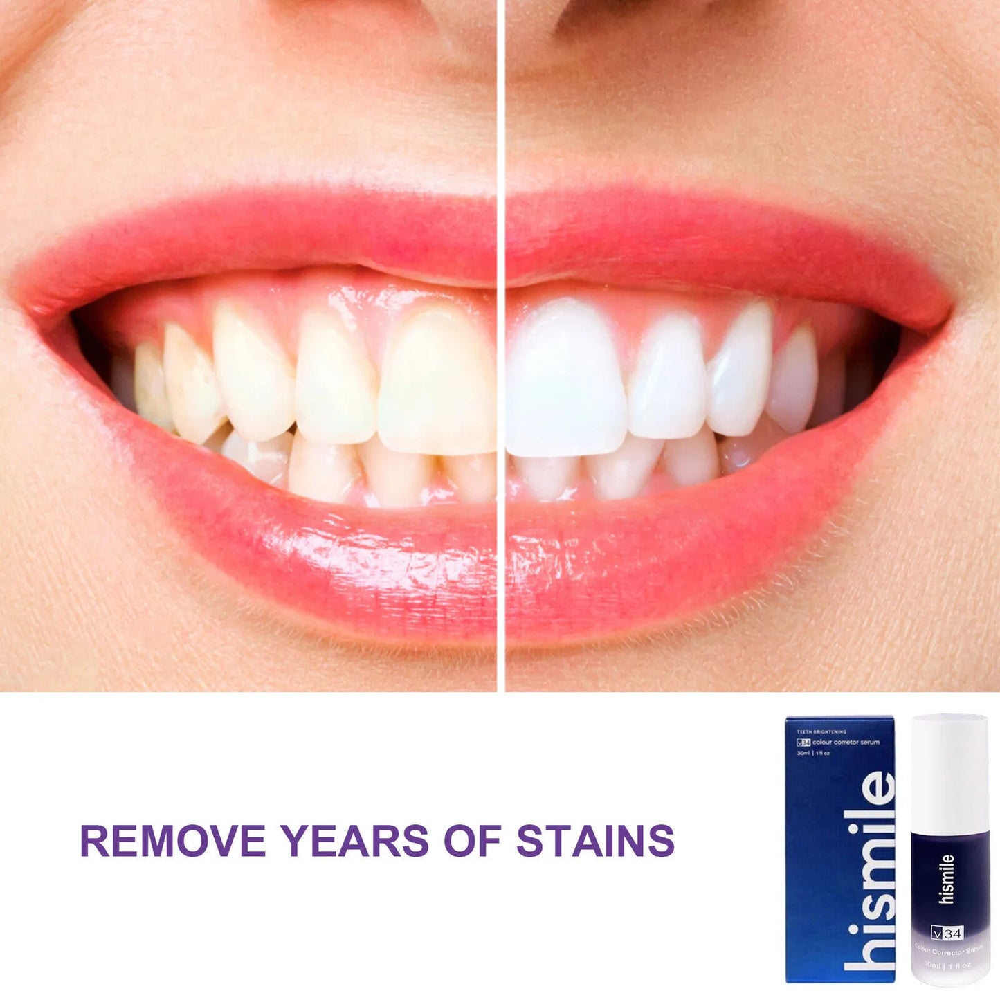 Purple Whitening Toothpaste – Color-Correcting for a Brighter Smile